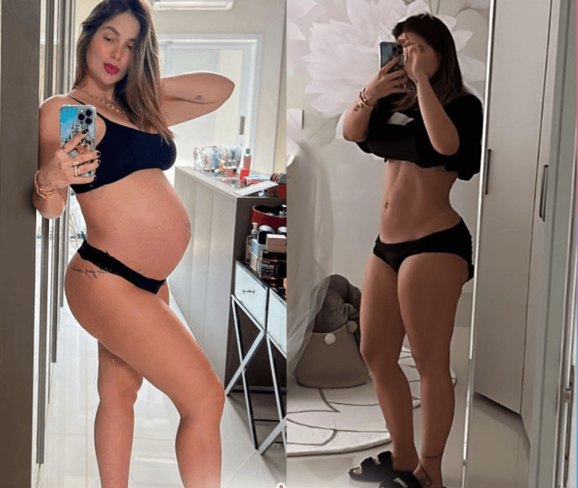 Virginia Fonseca mostrando antes e depois do pós parto (Foto Reprodução/Instagram) Virginia Fonseca mostrando antes e depois do pós parto (Foto Reprodução/Instagram)