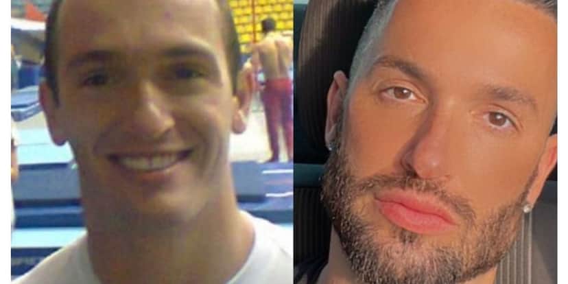 Colocou cabelo e mexeu no rosto: Diego Hypólito se transforma em galã de novela após mudança radical Colocou cabelo e mexeu no rosto: Diego Hypólito se transforma em galã de novela após mudança radical