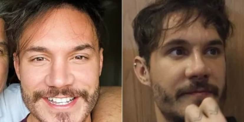 Nariz de Eliezer antes e depois de rinoplastia (Foto: Reprodução/Instagram) Nariz de Eliezer antes e depois de rinoplastia (Foto: Reprodução/Instagram)