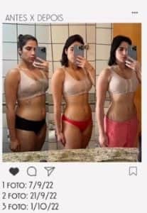 Jéssica Beatriz em foto do Instagram; filha de Leonardo mostrou detalhes do antes e depois (Foto: Reprodução / Instagram) Jéssica Beatriz em foto do Instagram; filha de Leonardo mostrou detalhes do antes e depois (Foto: Reprodução / Instagram)