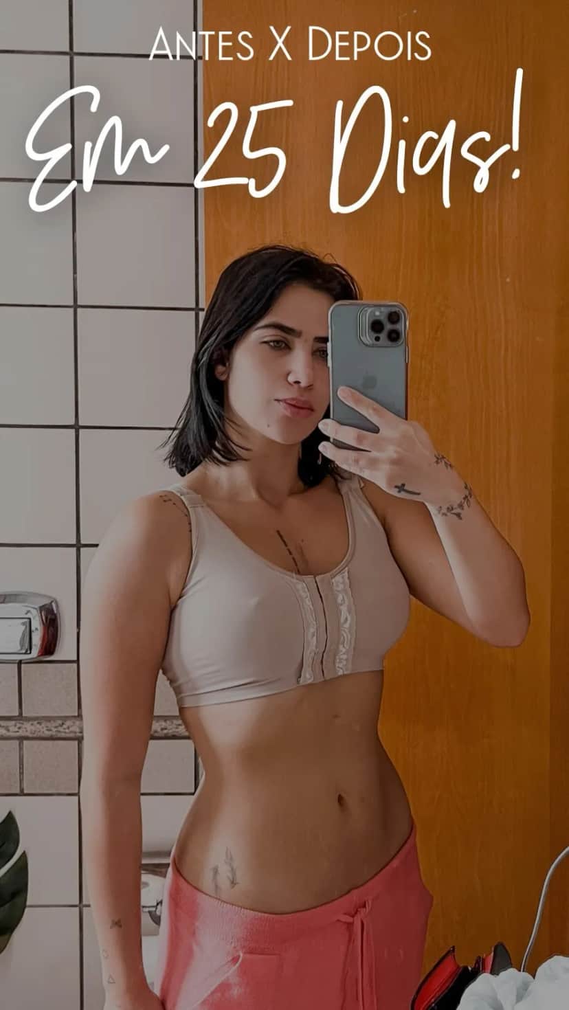 Jéssica Costa também fez harmonização facial (Foto Reprodução) Jéssica Costa também fez harmonização facial (Foto Reprodução)