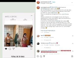 Jéssica Beatriz em foto do Instagram; filha de Leonardo mostrou detalhes do antes e depois (Foto: Reprodução / Instagram) Jéssica Beatriz em foto do Instagram; filha de Leonardo mostrou detalhes do antes e depois (Foto: Reprodução / Instagram)