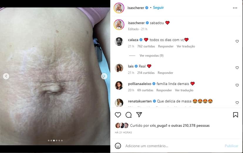 Isa Scherer, filha do nadador Xuxa, mostra barriga real um mês após o parto dos gêmeos - Foto: Reprodução