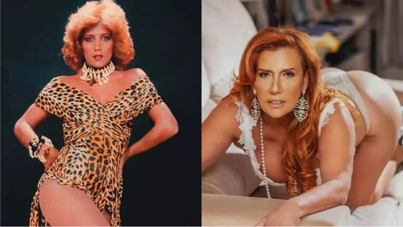 Diva do Chacrinha antes e depois dos procedimentos estéticos 