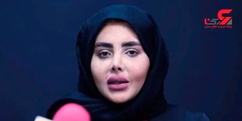 A verdadeira face de Sahar Tabar, mundialmente conhecida por "Angelina Jolie Zumbi" (Foto Reprodução/Internet) A verdadeira face de Sahar Tabar, mundialmente conhecida por "Angelina Jolie Zumbi" (Foto Reprodução/Internet)