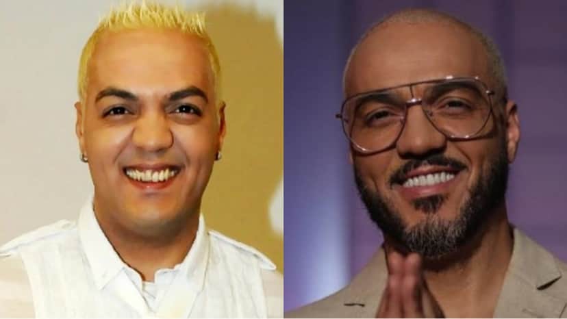 O cantor Belo antes e depois das lentes nos dentes (Reprodução) O cantor Belo antes e depois das lentes nos dentes (Reprodução)