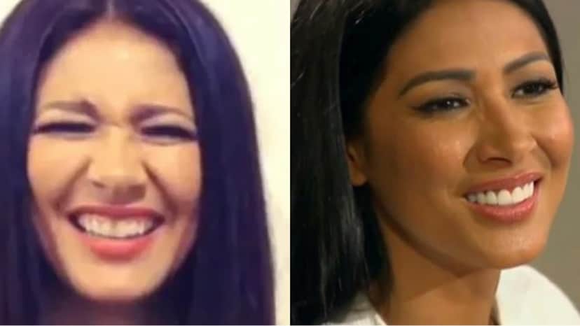 Simaria antes e depois das lentes nos dentes (Reprodução) Simaria antes e depois das lentes nos dentes (Reprodução)