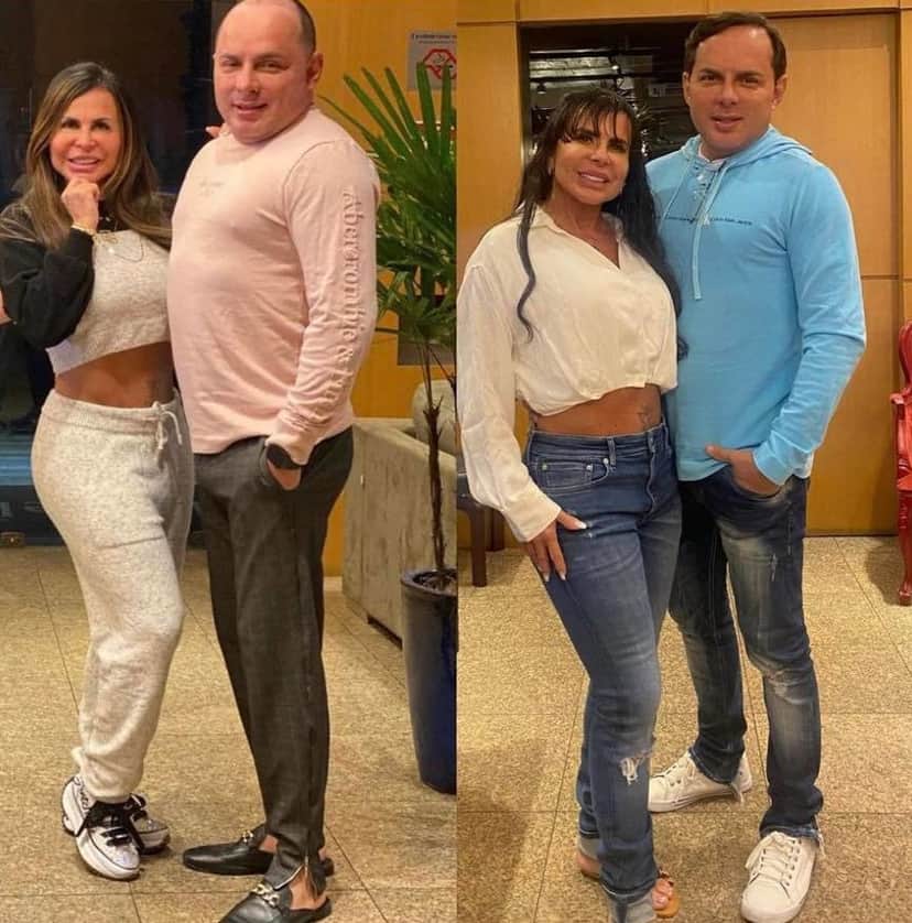 Marido de Gretchen mostra procedimentos e choca com resultado Marido de Gretchen mostra procedimentos e choca com resultado