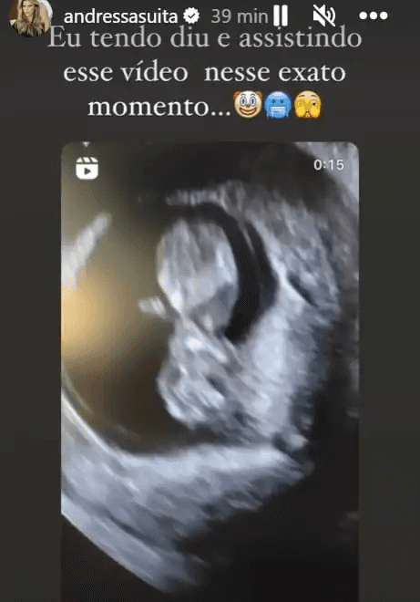 Post de Andressa Suita exibindo resultado de ultrassom nos stories (Foto: Reprodução/Instagram)