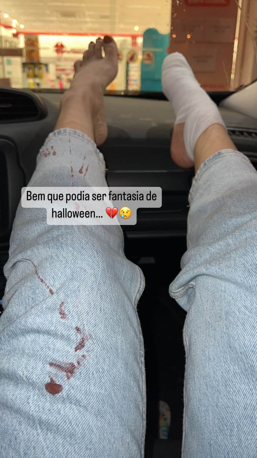 Sobrinha de Leonardo faz desabafo nas redes sociais após sofrer acidente - Reprodução Sobrinha de Leonardo faz desabafo nas redes sociais após sofrer acidente - Reprodução