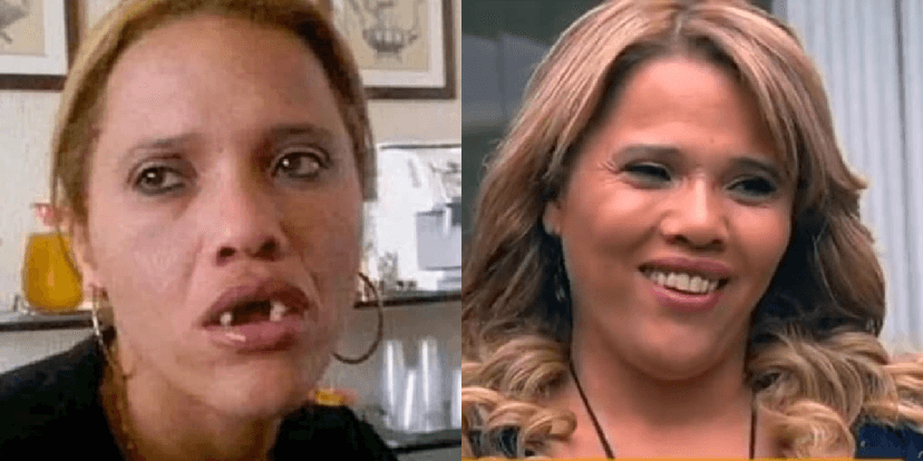 Antes e depois de Gorete (Foto: Divulgação) Antes e depois de Gorete (Foto: Divulgação)