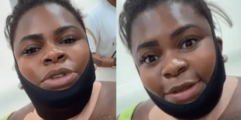 Jojo Todynho surgiu com o rosto enfaixado, mas tranquilizou os fãs ao explicar o motivo (Foto: Instagram) Jojo Todynho surgiu com o rosto enfaixado, mas tranquilizou os fãs ao explicar o motivo (Foto: Instagram)