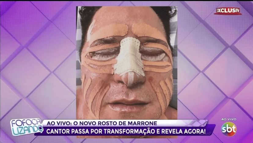 Marrone logo após sair da cirurgia (Foto: Reprodução/ SBT) Marrone logo após sair da cirurgia (Foto: Reprodução/ SBT)