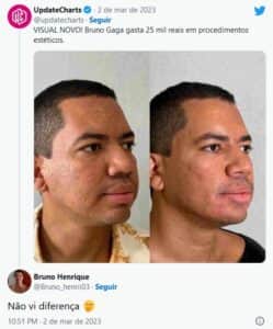 Internautas não gostaram do resultado da harmonização facial do ex-BBB23 (Foto: Reprodução / Twitter) Internautas não gostaram do resultado da harmonização facial do ex-BBB23 (Foto: Reprodução / Twitter)