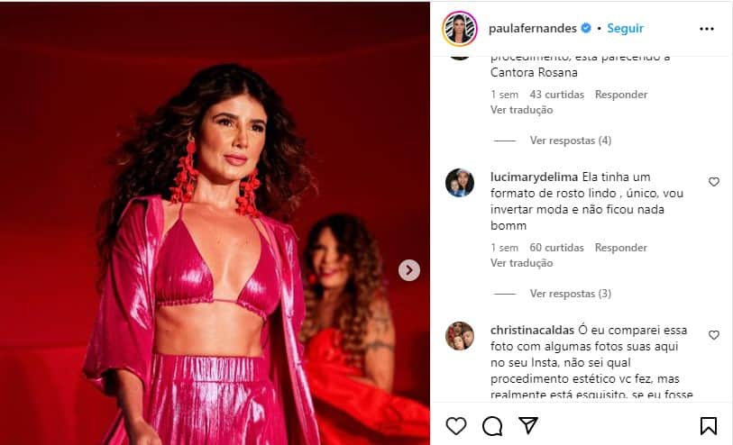 Paula Fernandes fez uma harmonização que não caiu bem (Foto: Reprodução)