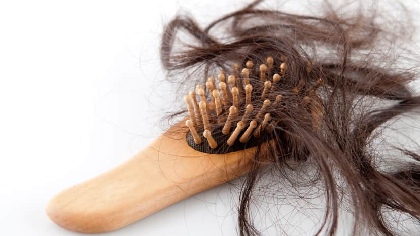 Motivos para perda de cabelo (Foto: Reprodução, Internet) Motivos para perda de cabelo (Foto: Reprodução, Internet)