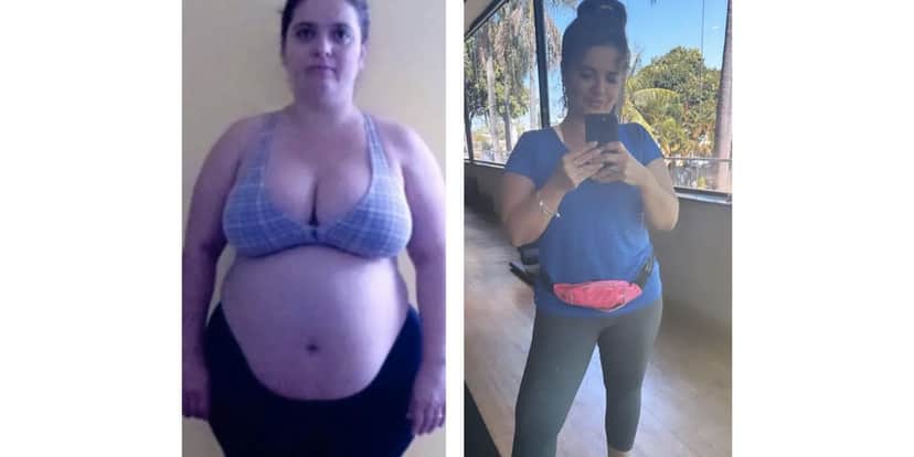 Antes e depois de famosa (Foto: Reprodução / Instagram) Antes e depois de famosa (Foto: Reprodução / Instagram)