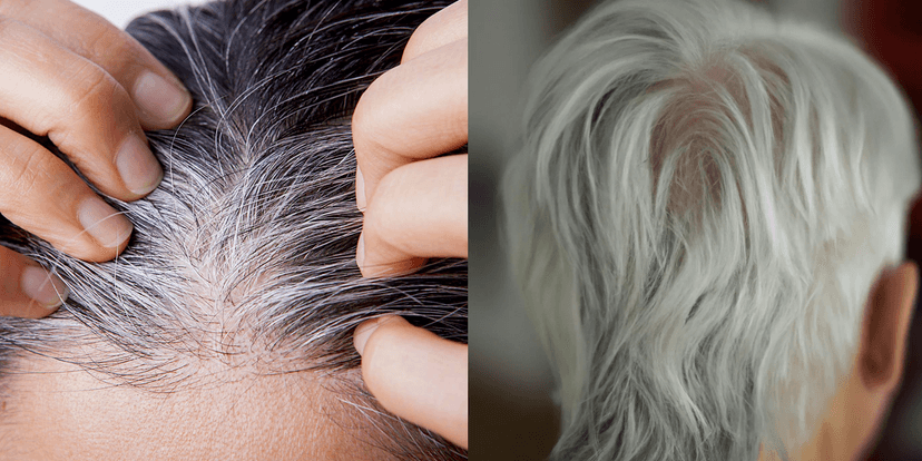 Cabelo branco (Foto: Reprodução, Salão Virtual) Cabelo branco (Foto: Reprodução, Salão Virtual)