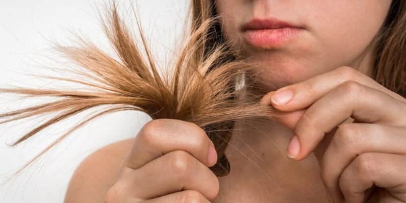 Cabelo Quebrado (Foto: Reprodução - Blog AMOBELEZA) Cabelo Quebrado (Foto: Reprodução - Blog AMOBELEZA)