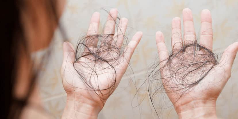 Queda de cabelo (Foto: Reprodução - GAZ) Queda de cabelo (Foto: Reprodução - GAZ)