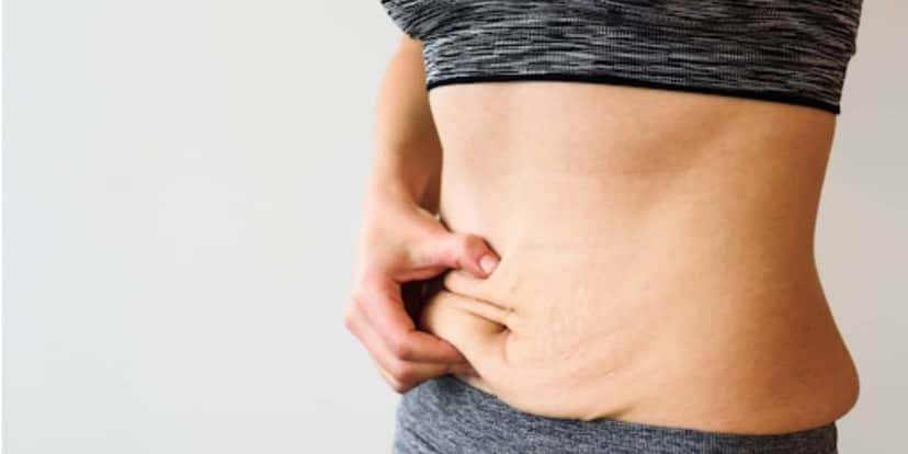 Adeus barriga flácida - (Foto: Reprodução / Internet) Adeus barriga flácida - (Foto: Reprodução / Internet)