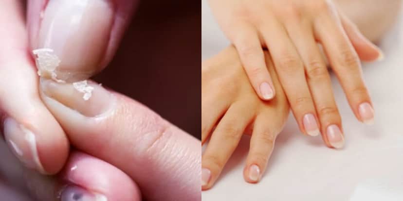 Fim das unhas fracas com essas dicas (Foto: Divulgação) Fim das unhas fracas com essas dicas (Foto: Divulgação)
