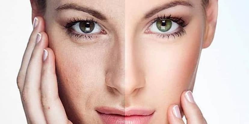 Botox caseiro com ovo dá fim às rugas quase instantaneamente (Foto: Reprodução Internet) Botox caseiro com ovo dá fim às rugas quase instantaneamente (Foto: Reprodução Internet)