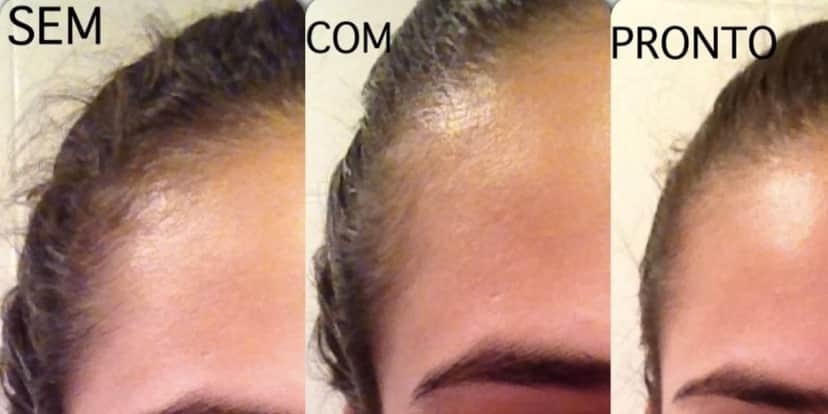 Antes e depois do serum (Reprodução/Internet) Antes e depois do serum (Reprodução/Internet)