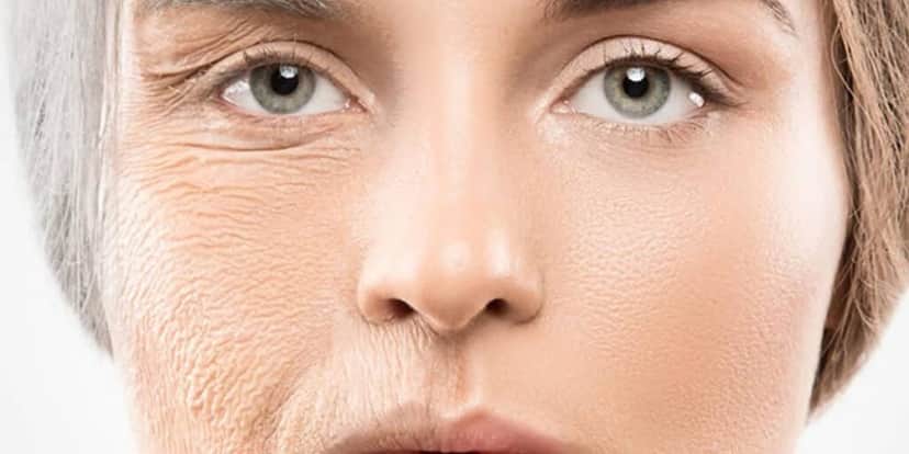 Pele sem e com colágeno (Foto: Reprodução- Cosmetici Inovation) Pele sem e com colágeno (Foto: Reprodução- Cosmetici Inovation)