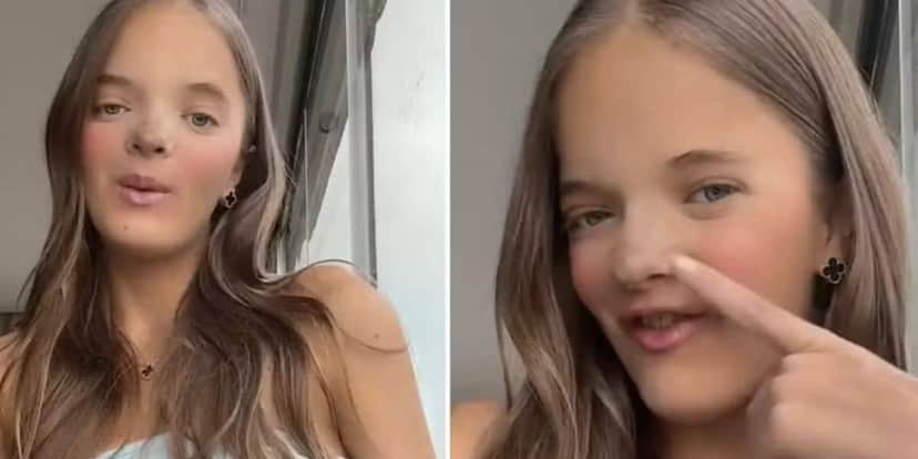 Rinoplastia Rafinha Justus (Foto: Reprodução / TikTok) Rinoplastia Rafinha Justus (Foto: Reprodução / TikTok)