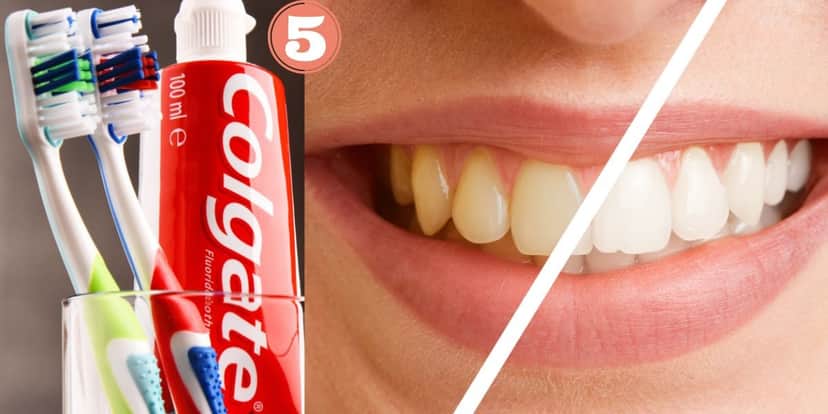 Colgate e clareamento dos dentes (Foto: Reprodução / Canva) Colgate e clareamento dos dentes (Foto: Reprodução / Canva)