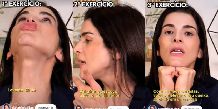 Exercícios para acabar com a papada (Foto: Divulgação) Exercícios para acabar com a papada (Foto: Divulgação)