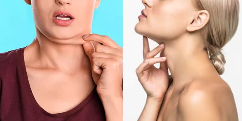 Com e sem papada (Foto: Reprodução - FreePick) Com e sem papada (Foto: Reprodução - FreePick)