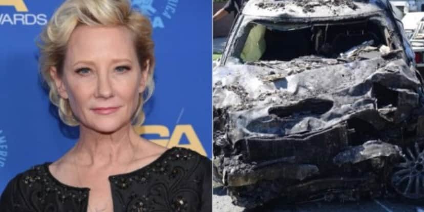 A atriz Anne Heche sofreu acidente de carro (Foto: Divulgação) A atriz Anne Heche sofreu acidente de carro (Foto: Divulgação)