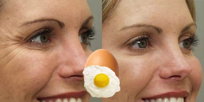 Um botox caseiro com ovo traz resultados melhores que harmonização (Reprodução: Montagem TV Foco) Um botox caseiro com ovo traz resultados melhores que harmonização (Reprodução: Montagem TV Foco)