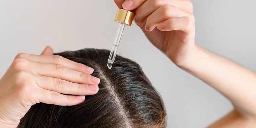 Cuidado ao aplicar o Minoxidil (Reprodução: Internet) Cuidado ao aplicar o Minoxidil (Reprodução: Internet)