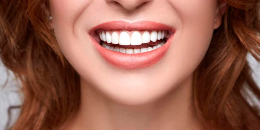Sorriso perfeito e dentes brancos (Foto: Divulgação) Sorriso perfeito e dentes brancos (Foto: Divulgação)
