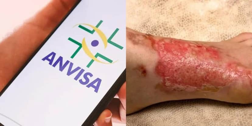Anvisa mandou barrar produto devido ao risco de queimadura (Foto: Divulgação) Anvisa mandou barrar produto devido ao risco de queimadura (Foto: Divulgação)