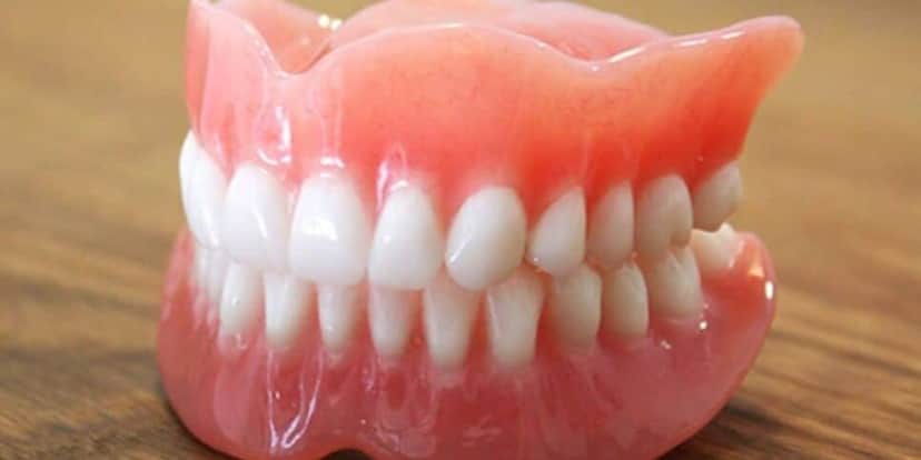 Os dentes tortos trazem a sensação de ser mais natural (Reprodução: Internet) Os dentes tortos trazem a sensação de ser mais natural (Reprodução: Internet)