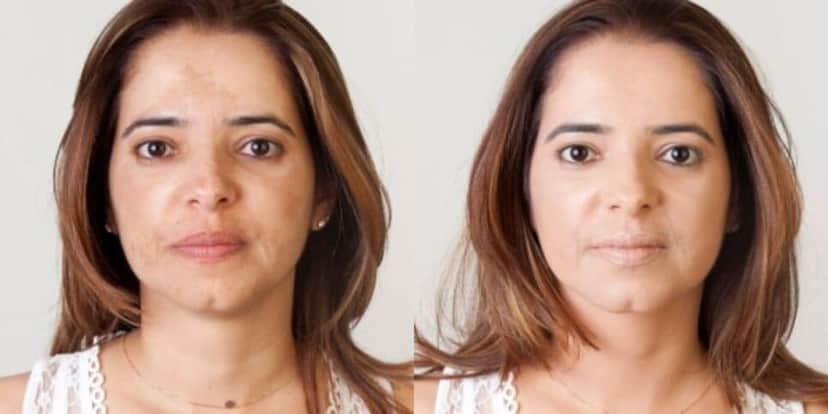 Acabe com as manchas da sua pele com essas 2 frutas (Reprodução: Internet) Acabe com as manchas da sua pele com essas 2 frutas (Reprodução: Internet)