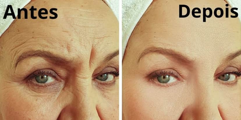 Rejuvenesça sua pele em até 30 anos com esse colágeno caseira (Reprodução: Montagem TV Foco) Rejuvenesça sua pele em até 30 anos com esse colágeno caseira (Reprodução: Montagem TV Foco)