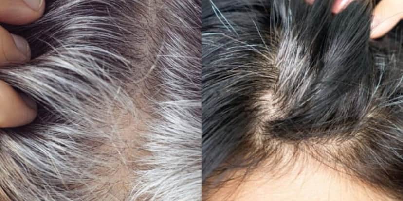 Cabelo branco (Foto: Divulgação) Cabelo branco (Foto: Divulgação)