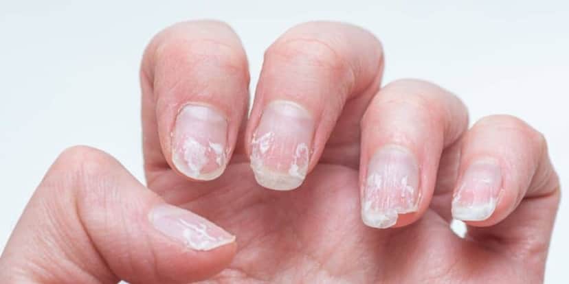 Tome todos os cuidados para não danificar suas unhas (Reprodução: Internet) Tome todos os cuidados para não danificar suas unhas (Reprodução: Internet)