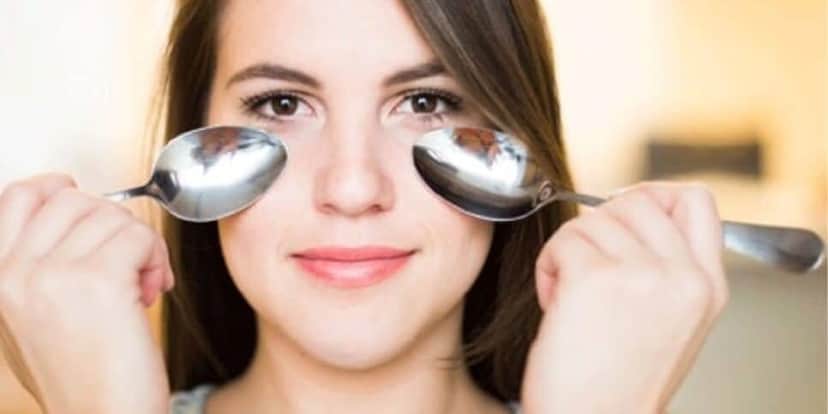 Dicas para acabar com as olheiras (Foto: Internet) Dicas para acabar com as olheiras (Foto: Internet)