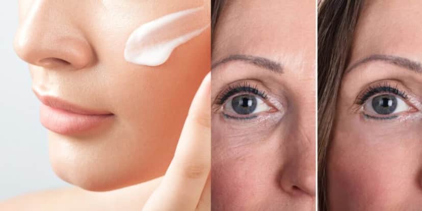 Creme natural tem o melhor colágeno do mundo e tira rugas com só 1 ingrediente - (Foto: Reprodução / Internet) Creme natural tem o melhor colágeno do mundo e tira rugas com só 1 ingrediente - (Foto: Reprodução / Internet)