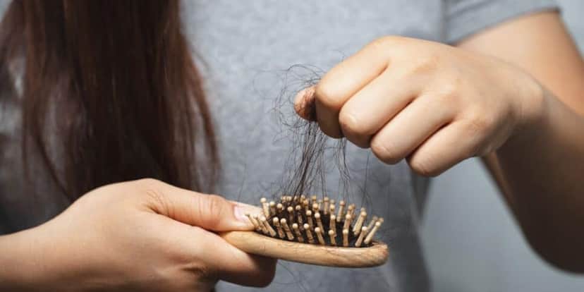 Cabelo, Alopecia Cabelo, Alopecia