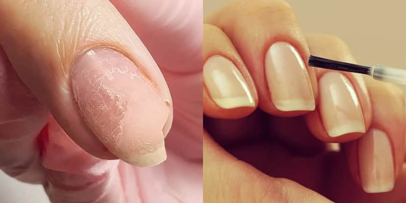 Unhas quebradiças e unhas perfeitas (Foto: Reprodução/ Internet)