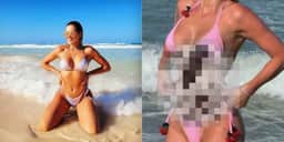 Lívia Andrade faz lipo led e antes e depois é a imagem mais chocante que você verá hoje