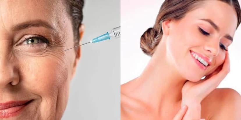 Creme antirrugas é melhor que botox (Foto: Montagem) Creme antirrugas é melhor que botox (Foto: Montagem)