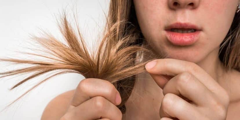 Cabelo Oleoso, Cabelo Branco Cabelo Oleoso, Cabelo Branco